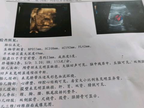 journal_insert_pic_1555080636