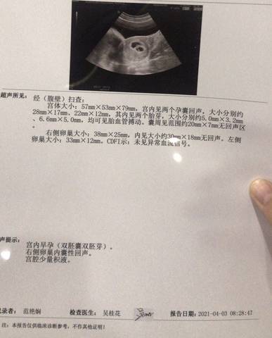 journal_insert_pic_1559805574