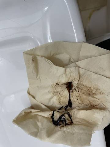 育儿问答 怀孕期 孕七周.