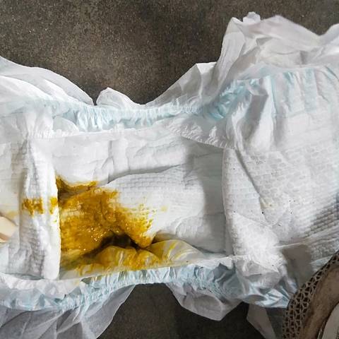 育儿问答 1-3岁 宝宝两个多月,吃母乳的时候肚子有时咕咕叫,吃了就拉