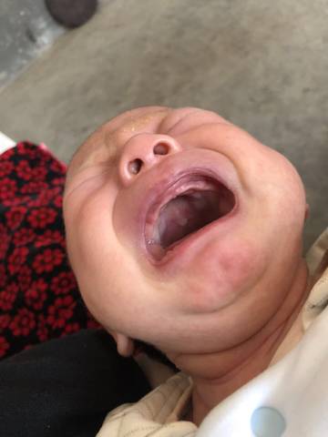 婴儿吸奶口腔内部图图片