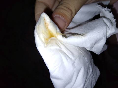 苍白!剖腹产后恶露一般要多久"算是实力"-第2张图片-万宝网