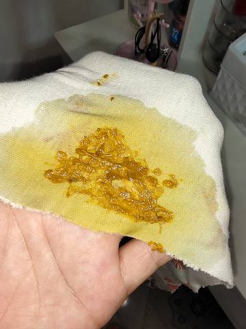 宝宝一直拉这样的便便正常吗?