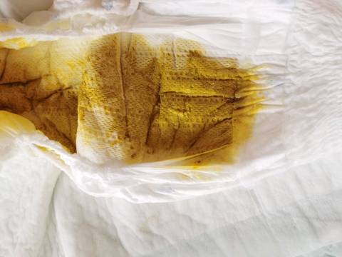 这个大便谁会看