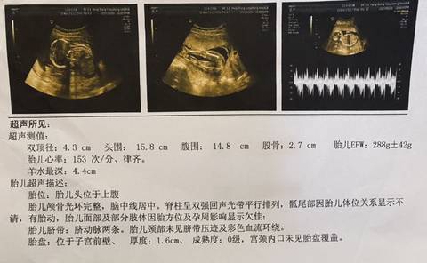 18周b超能看出男女嗎?