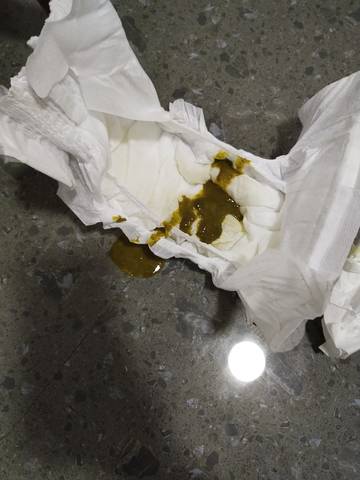 宝宝查微量元素缺铁,有贫血,这几天吃贫血药,窝的粑粑是这种,拉肚子了