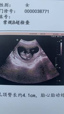 孕8周彩超图片看男女图片
