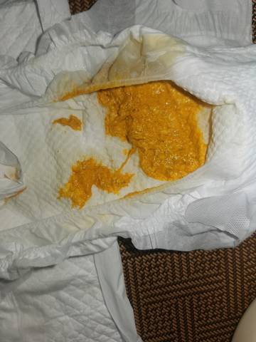 宝宝半夜拉的,请问这样的粑粑正常吗?谢谢了