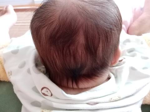 宝宝脑勺为什么有凹槽?是不是头睡扁的原因,这个会不会有害呀?