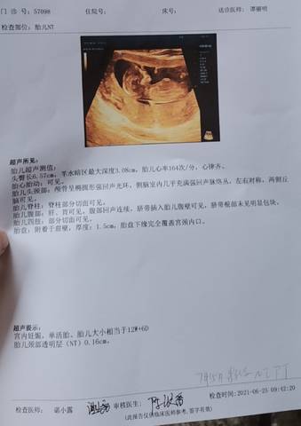 我的nt检查,好开心!_育儿问答_宝宝树