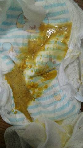 五个多月的宝宝拉两天这种便便了,怎么办,母乳喂养的