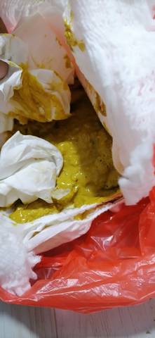 是脾胃不好?还是着凉了?