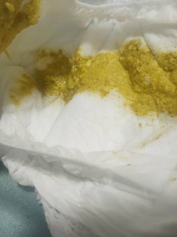 宝宝87天现在出现消化不良吃奶少了肚子胀气鼓鼓的屁少了睡眠倒是不