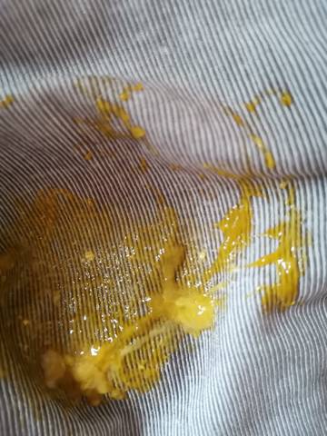 亲们,四个月的宝宝,拉的便便,像白带似的东西,这是什么情况?