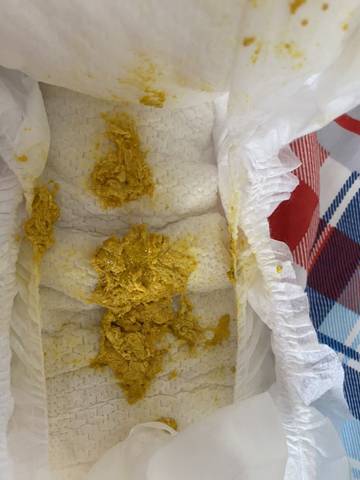 满月宝宝拉臭臭,正常吗?