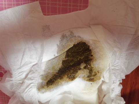 宝宝拉这种粑粑是怎么了