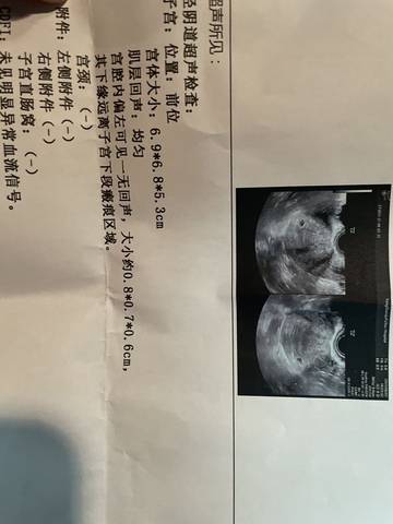 6周彩超显示宫腔内偏左可见一无回声偏左还能恢复正常么还有6 2为什么还没胎心胎芽好担心 宝宝树