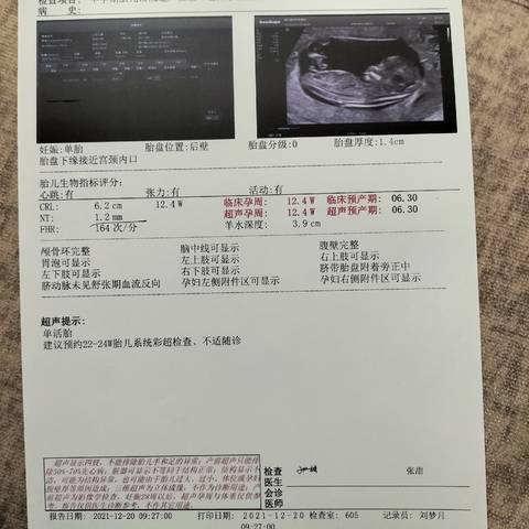 journal_insert_pic_1710495981
