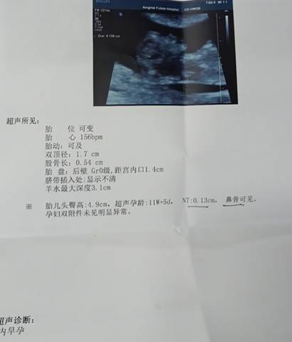 journal_insert_pic_1735239082