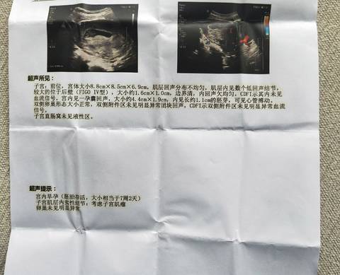 journal_insert_pic_1781057085