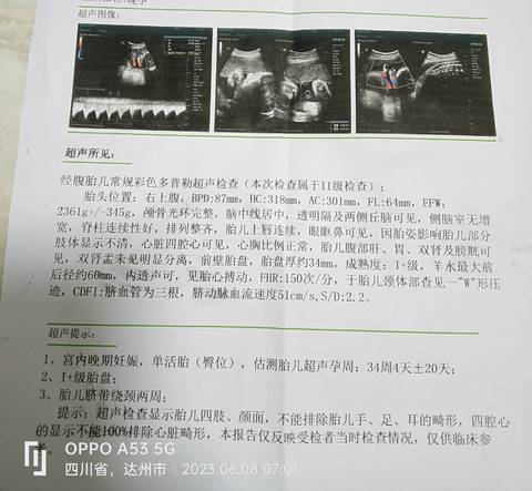 journal_insert_pic_2028171260