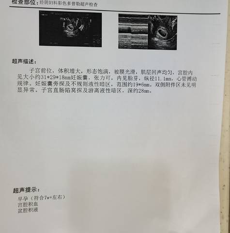 journal_insert_pic_2029853556
