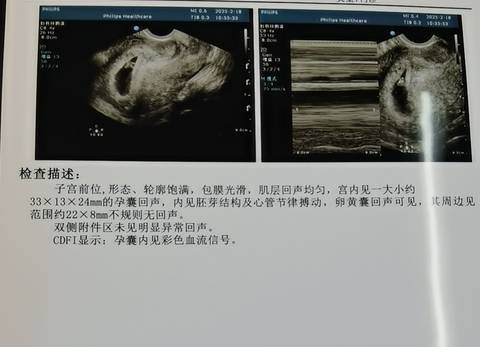 journal_insert_pic_4125344401