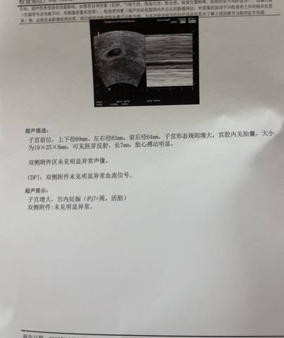 journal_insert_pic_4362921847