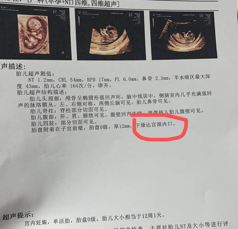 journal_insert_pic_4414810980