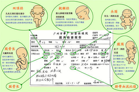 journal_insert_pic_1077766901