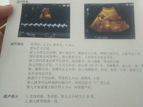journal_insert_pic_1116910330