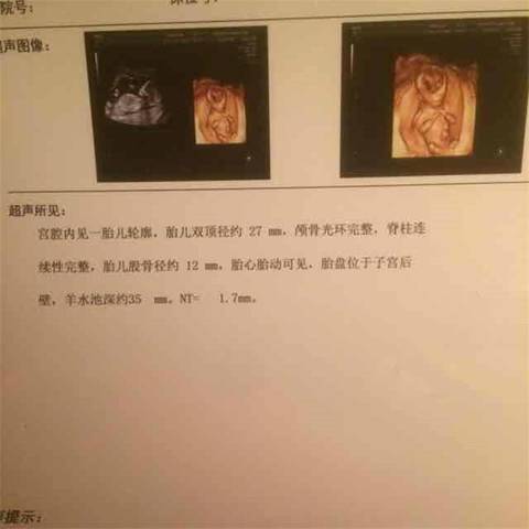 journal_insert_pic_1147566536