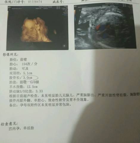 journal_insert_pic_1520923606